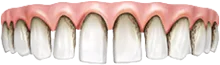 Имплантация зубов - Стоматология "Мандарин" - 2