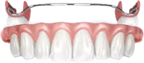 Имплантация зубов - Стоматология "Мандарин" - 4