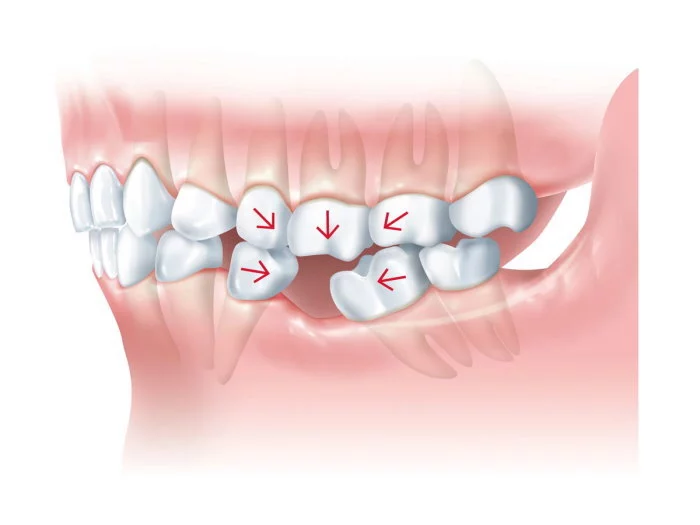 Протезирование зубов - Стоматология "Мандарин" - 1