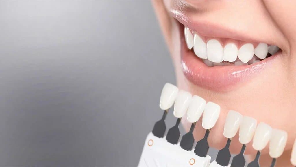 Эстетическая стоматология - Стоматология 