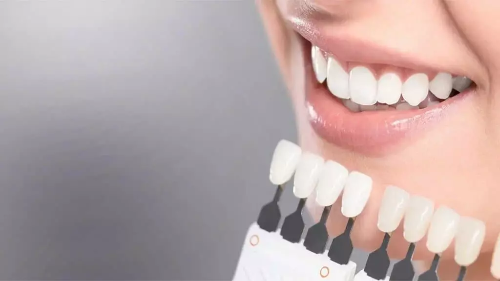Эстетическая стоматология - Стоматология "Мандарин" - 1