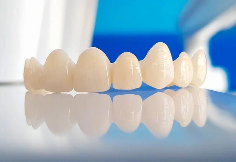 Эстетическая стоматология - Стоматология 