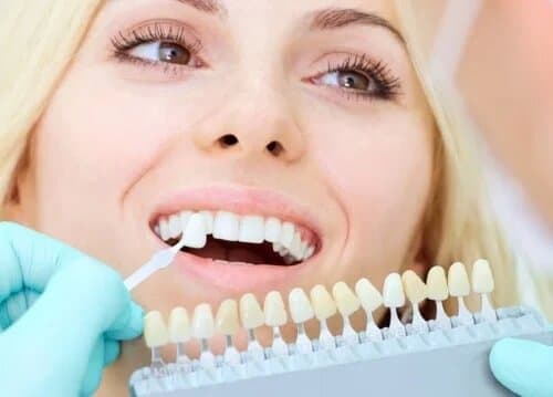 Художественная реставрация зуба - Стоматология 