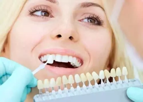 Художественная реставрация зуба - Стоматология "Мандарин" - 1
